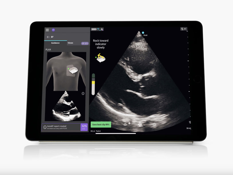 GE HEALTHCARE INTRODUCES CAPTION AI ON VSCAN AIR SL